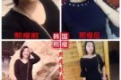 熙瘦瘦身胶囊！不节食不需要运动！独家代理！！！活动时间有限！！！