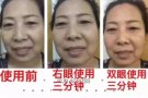 去除眼袋！去除黑眼圈！就是這麼簡單 【三分钟见效】微信：3214985723 