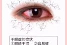 VXON护眼内调