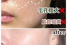 专业机打水光针！无效不收费！价格优惠！
