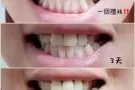 Dr.MIN净白牙粉