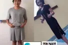 拔罐减肥-$58 一次见效！