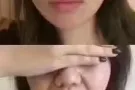 韩式微整双11大优惠哦