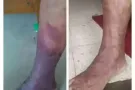 招兵买马