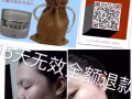 祛痘膏专治痘痘，痘印，美白，控油，承诺无效全额退款。