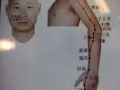 上门服务 中医经络理疗師  Benson  1小时S$50