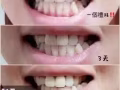 Dr.MIN净白牙粉