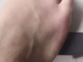 脚气病的克星