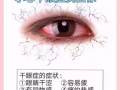 VXON護眼內調
