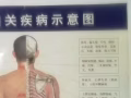 偏頭疼頻發作難好、口瘡頻發