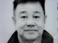 疼痛治疗师