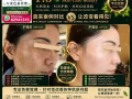 色素管理专业祛斑祛痘痘印痘坑修护中心草本护肤洗脸WhatsApp:82941315